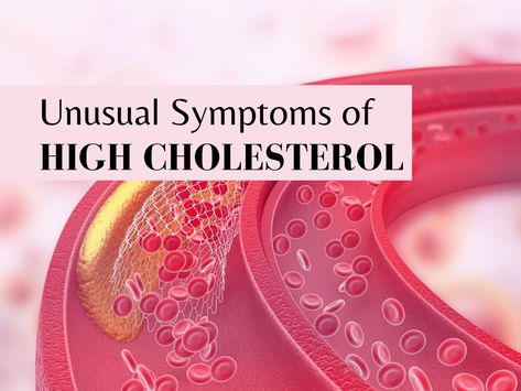 Symptoms Of High Cholesterol, Signs Of High Cholesterol, High Cholesterol Symptoms, Enlarged Liver, Cholesterol Symptoms, High Cholesterol Levels, Unhealthy Diet, Lifestyle Habits, High Cholesterol