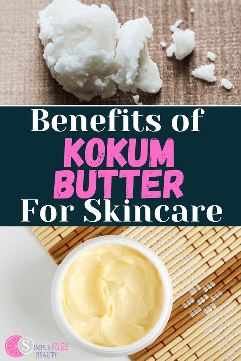 Thinking about adding Kokum Butter to your own DIY recipe? Kokum Butter’s benefits for skin are amazing. Kokum Butter is a great moisturizer and helps fight aging! Kokum Butter benefits also include keeping skin hydrated and smooth. It is the perfect ingredient to keep your skin happy and healthy; want to know more about Kokum Butter benefits for skin? Let’s dive in! Kokum Butter Lotion Recipe, Kokum Body Butter Recipe, Kokum Butter Recipe, Coco Butter Aesthetic, Kokum Butter Benefits, Body Butter Benefits, Mango Butter Benefits, Shea Body Butter Recipe, At Home Skincare