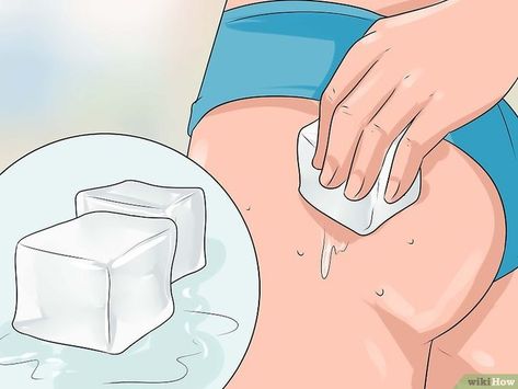 How to Get Rid of Acne on the Buttocks