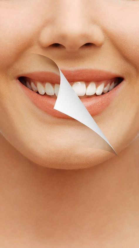 Teeth Whiteners, Dental Studio, Teeth Whitening Homemade, Teeth Whitening Diy, Whiten Teeth, Teeth Health, Dental Art, Natural Teeth Whitening, Natural Teeth