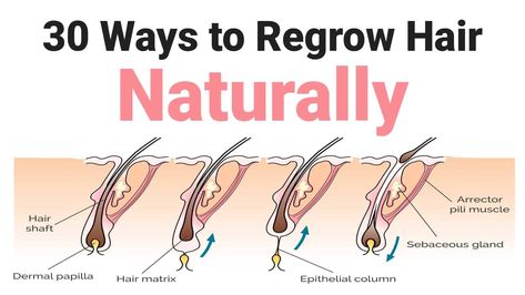 Regrow Hair Naturally, Natural Hair Regrowth, Calendula Benefits, Hair Regrowth Treatments, Regrow Hair, Lost Hair, Essential Nutrients, Beauty Makeup Tips, Hair Regrowth