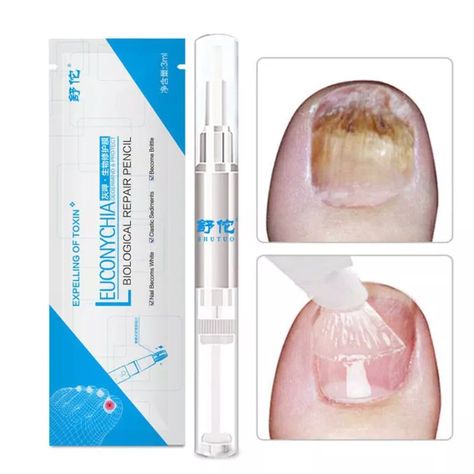 anti fungal nail treatment diy Natural Nail Care, Nail Infection, Nail Pen, Fungal Nail, Fall Makeup Looks, Nail Repair, Nail Oil, Ingrown Toe Nail, Winter Makeup