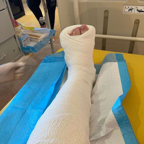 Broken Leg In Hospital, Iphone Wallpaper Unicorn, People Tattoos, Black People Tattoos, Medical Boot, Hospital Admit, Ankle Surgery, Cool Galaxy Wallpapers, Leg Injury