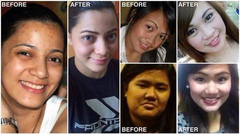 some of glutathione injectable before and after pics. Results are not typical. www.whitechic.net Glutathione Before And After, Glutathione Skin, Foundation For Oily Skin, Before And After Pics, Lipstick For Fair Skin, Best Teeth Whitening, Skin Lightening, White Skin, Lighten Skin