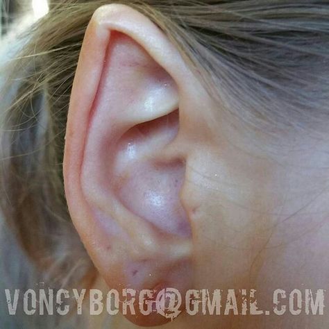 Healed ear pointing by: Samppa Von Cyborg Pointed Ears Aesthetic, Pointed Ears Body Modifications, Ear Pointing Body Mod, Elf Ear Modification, Werewolf Ears, Stretched Septum, Body Modification Piercings, Corset Training, Pointed Ears