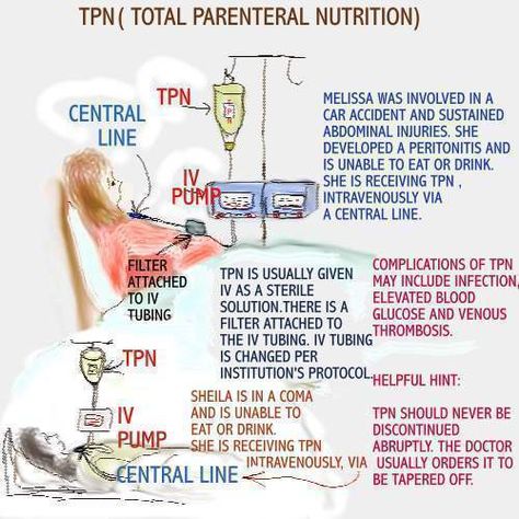 Tpn Nursing, Med Surg 2 Nursing, Total Parenteral Nutrition Nursing, Parenteral Nutrition, Peritonitis Nursing, Total Parenteral Nutrition, Digoxin Nursing Mnemonics, Neutropenic Precautions Nursing, Urinalysis Interpretation