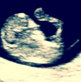 Hello from Utero - diaries of a pregnant scary-cat! #pregnancy Cat Pregnancy, Scary Cat, Baby Pregnancy, My Baby, Quick Saves