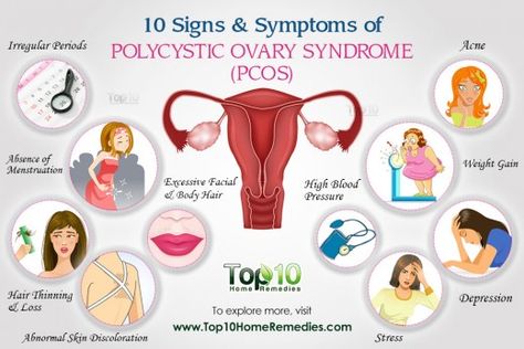 Summary of PCOS Symptoms Cystic Ovarian Syndrome, دورة شهرية, Top 10 Home Remedies, Polycystic Ovarian Syndrome, Polycystic Ovaries, Skin Discoloration, Hormone Imbalance, Signs And Symptoms, Acupuncture