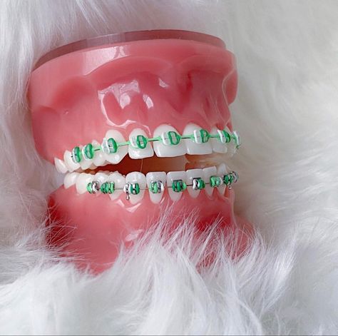 Lime Green Braces, Mint Green Braces, Powerchain Braces Green, Powerchain Braces Color, Teal Power Chain Braces, Braces Colors Combinations, Dental Braces Colors, Green Braces, Sparkle Nail Designs