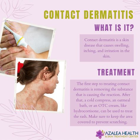 Contact Dermitis Hands, Contact Dermitis Rash, Lichen Planus, Itchy Rash, Home Remedies For Skin, Skin Bumps, Scaly Skin, Beauty Oil, Skin Diseases