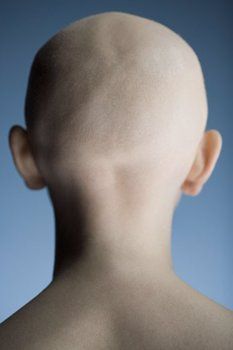 Head Angles, Bald Women, Female Head, Bald Heads, Anatomy Reference, Human Face, Back View, Photography Women, Art Reference Poses