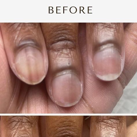 Jai on Instagram: "🚨 New Client Alert 🚨 

Take a look at this before and after… look at how much difference a manicure makes when it comes to having your nails done! Look at how much space we freed up on her nail plate by doing detailed cuticle work. 

S W I P E to see how we designed her nails 😍

♡⠀⠀⠀⠀⠀⠀⠀⠀⠀
♡⠀⠀⠀⠀⠀⠀⠀⠀⠀
♡⠀⠀⠀⠀⠀⠀⠀⠀⠀
♡⠀⠀⠀⠀⠀⠀⠀⠀⠀

#atxnails #atxnailtech #atxnailsalon  #nailtech #structuredgelmanicure #art #naturalnails  #fortcavazos #naildesigns #atxhairstylist #atxhair #pflugervilletexas #gelmanicure #pflugervilletx #pflugervillehairstylist #pflugervillelashes #austinstylist  #roundrocktx #georgetowntx #abstractnails #texasnails #roundrocknailtech #TheBrownJaiLing #austinnails #austinnailtech #shortnails
#abrowngirlwithanailbrush" Pflugerville Texas, Texas Nails, Georgetown Tx, Her Nails, Nails Done, Nail Plate, Round Rock, Gel Manicure, Nail Tech