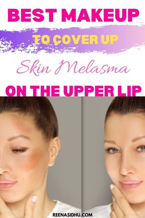 You’ve just finished applying foundation, concealer, and powder to your whole face, only to discover that your hyperpigmentation is still visible. What’s going on? Suppose you have Melasma (a form of hyperpigmentation marked by brown spots on the cheeks, forehead, and upper lip). In that case, you know how tough it is to conceal the condition. When it comes to the best makeup to cover Melasma on the upper lip, there are a lot of factors to consider How To Cover Hyperpigmentation With Makeup, Color Correction Makeup, Camouflage Makeup, Upper Lip Hair, Applying Foundation, Face Only, The Best Makeup, Upper Lip, Brown Spots