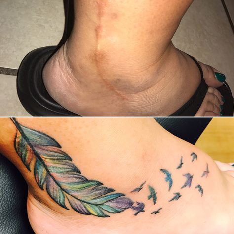 Scar cover up! Ankle Tattoo To Cover Scar, Ankle Scar Tattoo Ideas, Tattoo Ideas For Scar Cover Up, Surgical Scar Tattoo Cover Up, Ankle Scar Tattoo Cover Up, Knee Scar Tattoo Cover Up, Ankle Scar Tattoo, Tattoo Ideas To Cover Scars, Tattoo Scar