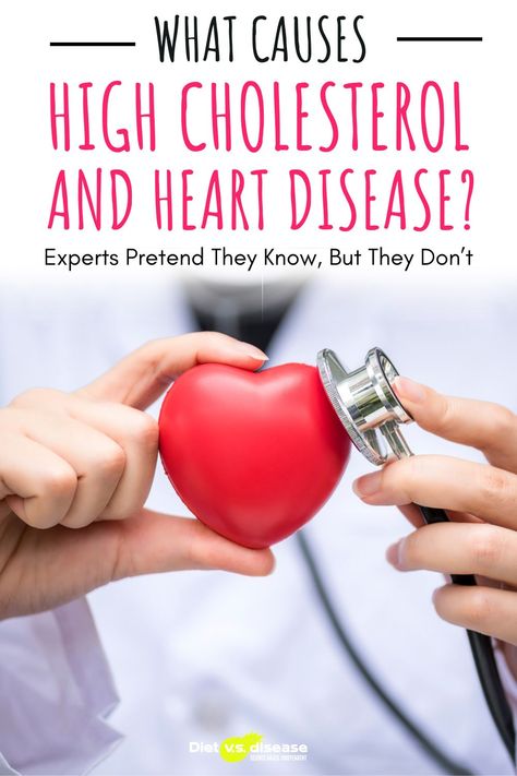 It attempted to explain why cholesterol is not related to heart disease risk, somewhat supportive of the Cholesterol Myth mindset.I found this to be true of myself, regularly eating so-called high cholesterol foods with little change to my blood readings. That is, as a healthy young adult. The original article was to be titled: What Causes High Cholesterol? The Outdated Question That Will Kill You. #health #nutrition #cholesterol High Cholesterol Foods, What Causes High Cholesterol, Lowering Cholesterol, Blood Pressure Numbers, High Blood Pressure Remedies, Cholesterol Foods, Health Women, Reducing High Blood Pressure, Blood Pressure Medications