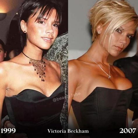 ➖ @rbitalia Celebrities who have admitted getting breast implants These women are absolutely gorgeous, both in the photo Before and After. 😍 Thoughts? Breast Lift Before And After, Breast Lift, Fashion Addict, Fashion Photographer, Fashion Lover, Fashion Blog, Fashion Photography, Fashion Blogger, Fashion Week