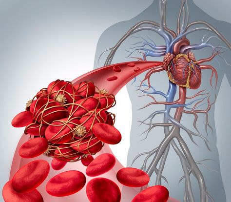 Venous Insufficiency, Atrial Fibrillation, Vitamin K2, Red Blood, Red Blood Cells, Blood Cells, Heart Health, Blood Vessels, Heart Healthy