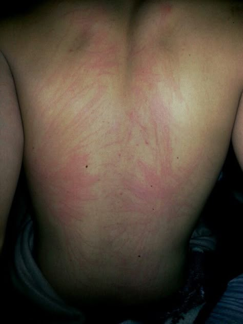 scratch marks ♡ Claw Marks On Back, Scratching Boyfriend Back, Back Scratches From Nails Boyfriend, Back Claw Marks Aesthetic, Aggressive Hand Placement Boyfriend, Nails Scratching On Back Couple Pic, Nails Scratching On Back Couple, Nail Marks On Back, Scratched Back From Nails Men Aesthetic