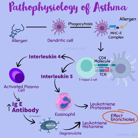 Ninja Nerd Lecture summary (Asthma pathophysiology) Asthma Notes, Asthma Pathophysiology, Pathophysiology Notes, Human Body Vocabulary, Pathophysiology Nursing, Nclex Practice Questions, Medical Notes, Nursing School Notes, Science Notes