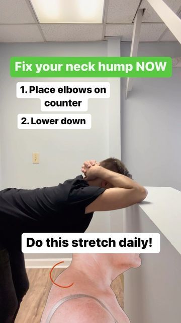 Forward Head Posture Exercises, Posture Correction Exercises, Healing Massage, Neck And Shoulder Exercises, Neck Hump, Body Massage Techniques, Trening Sztuk Walki, Lower Back Pain Exercises, Neck Exercises