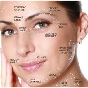 Botox Injection Sites, Chin Wrinkles, Botox Brow Lift, Forehead Acne, Botox Cosmetic, Facial Fillers, Facial Aesthetics, Neck Wrinkles, Botox Fillers