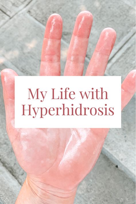 hyperhidrosis Hyperhydrosis Hands Aesthetic, How To Stop Sweaty Hands, Hyperhydrosis Hands, Sweaty Hands Remedy, Sweating Remedies, Sweaty Palms, Heart Diet, When To Plant Vegetables, Sweaty Hands