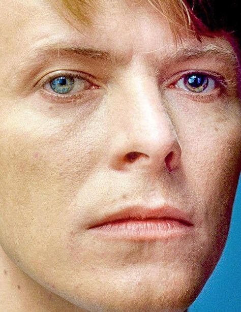 It's all in those eyes! David Bowie Eyes, Bowie Eyes, David Bowie Music, David Bowie Fashion, Nose Jobs, Bad Skin, Bad Teeth, Fantastic Voyage, Johnny Cash