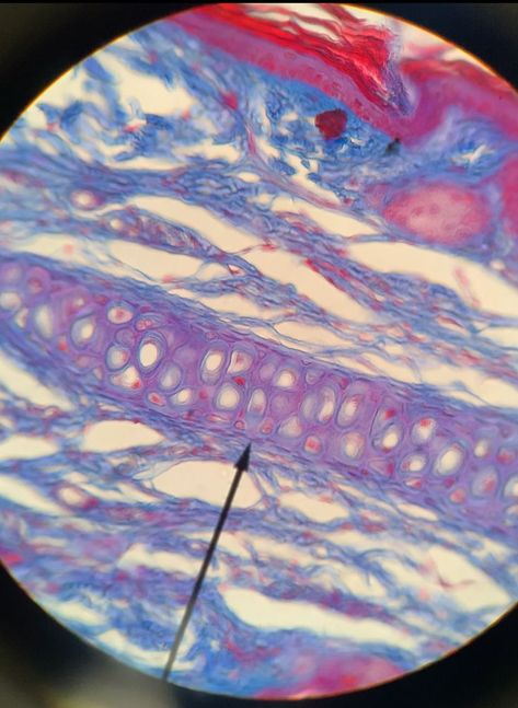 Hyaline Cartilage, Matrix, Anatomy, Medicine, Elastic, Quick Saves