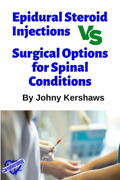 Spinal conditions can cause excruciating pain and significantly impact one's quality of life. Whether it's a herniated disc, spinal stenosis, or other issues, individuals facing spinal problems often seek relief through medical interventions. Two common approaches to managing spinal conditions are Epidural Steroid Injections (ESIs) and surgical procedures. Spinal Injections, Epidural Spinal Injections, Spinal Tracts, Foraminal Stenosis Lumbar, Lumbar Spinal Canal Stenosis Exercises, Stenosis Of The Spine, Spinal Degeneration, Spinal Fusion Surgery, Lumbar Disc