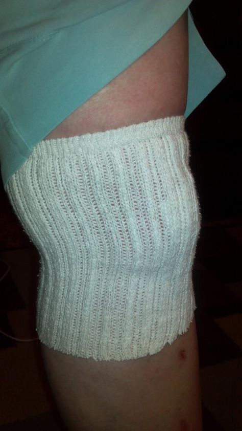 For knee wounds, dress it with gauze then cut the top off of a crew sock and stretch it over the injury. It keeps the gauze in place, allows the wound to breathe, and does not cause irritation to the back of the knee. Knee Injury Pics, Injury Aesthetic, Wind Pictures, Woman Laying, Knee Injury, Crew Sock, Pretty Eyes, Braid Styles, Knee High Sock