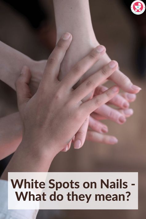 Have you noticed White Spots on Nails on your child's hands or feet? Find out what they could be and what you can do about them. White Spots On Fingernails, White Spots On Nails, Nail Care Diy, Baby Food Chart, Brittle Nails, Nail Plate, Cosmetic Procedures, Simple Home, Dipped Nails