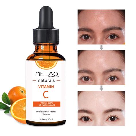 Vitamin E Serum, Best Vitamin C Serum, Dark Armpits, Natural Vitamin C, Best Vitamin C, Moisturizing Face, Natural Vitamins, Vitamin C Serum, Sun Damage