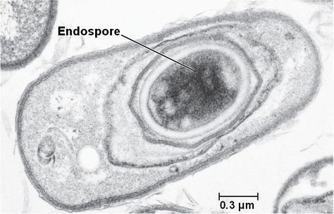 endospore in Bacillus anthracis Bacillus Anthracis, Microbiology Study, Branches Of Science, Preventative Health, Microbiology, What Is Life About, Science And Nature, Biology, Science