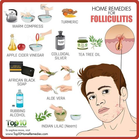 Sagging Skin Remedies, Back Acne Remedies, Pimples On Forehead, Thick Hair Remedies, Top 10 Home Remedies, Hair Growth Remedies, Remedies For Acne, Sleep Insomnia, Growing Hair