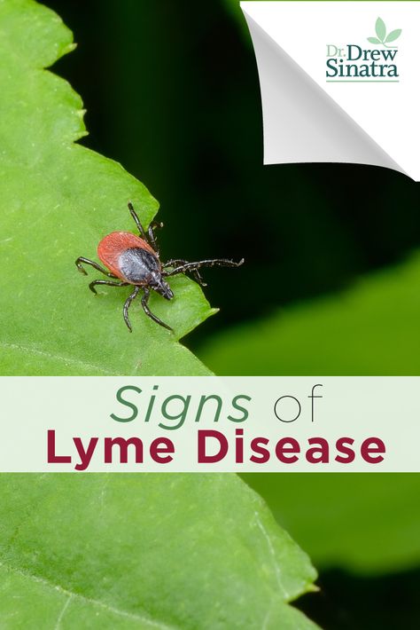 The symptoms of Lyme disease are very similar to other sicknesses, such as the flu. Read this to know how to distinguish them and get help (if you need it) immediately! Lymes Disease, Naturopathic Medicine, Natural Therapy, Signs And Symptoms, Natural Treatments, Detective, Health Tips, Disease, Medicine