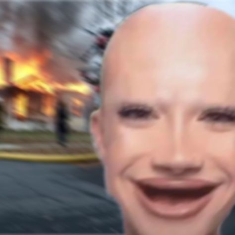 BALD JAMES CHARLES WITH NO TEETH SETTED MY HOUSE ON FIRE 🔥🔥🔥🔥 Bald James Charles With No Teeth, Cursed James Charles Images, James Charles Funny Pictures, Random Pictures To Airdrop People, Bald James Charles, Cursed Celebrity Images, James Charles Cursed Image, Cursed James Charles, James Charles Aesthetic