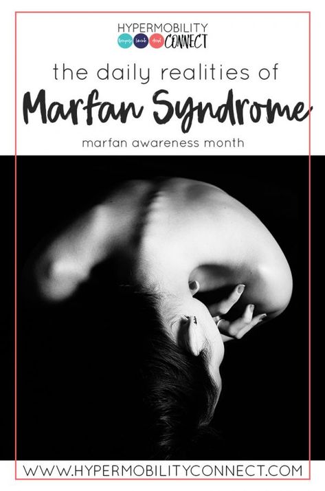 February is Marfan Syndrome Awareness Month! Lucy shares on the Daily Realities of living with Marfan Syndrome on the #hypermobilityconnect blog  #marfansyndrome #marfansyndromeawarenessmonth #hypermobility Marfans Syndrome, Funny Random, Get It Done, Getting Things Done, Random Stuff, Blog Posts, Elephant, Computer, Funny