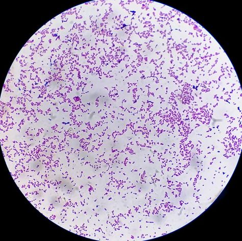 Microscopic view of gram stain showing e... | Premium Photo #Freepik #photo #bacteria-background #microorganism #bacterial #bacterium Gram Staining, E Coli Bacteria, Microbiology Study, Tissue Biology, Microscope Pictures, Yemen Flag, Gram Negative Bacteria, Under Microscope, Science Girl