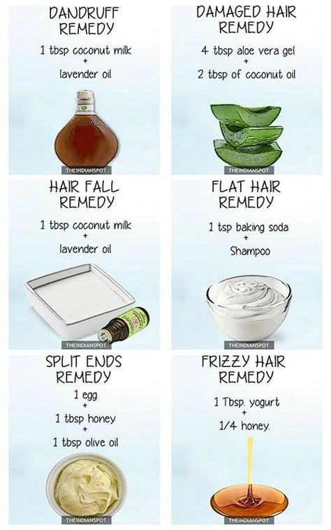 Damaged Hair Remedies, Frizzy Hair Remedies, Hair Mask For Dandruff, Hair Problem, Dandruff Remedy, Hair Dandruff, Diy Hair Mask, Hair Remedies, Sisterlocks