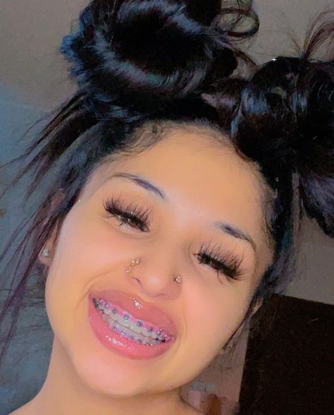 Braces Aesthetic Purple, Cute Braces Colors For Light Skin, Purple Braces For Black Women, Smiley Piercing With Braces, Light Purple Braces, Purple Braces, Girls With Braces Aesthetic, Neon Pink Braces, Brackets Aesthetic