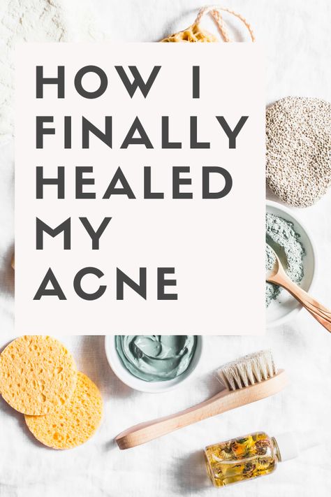 Do you struggle with acne? In this post I talk about how I naturally cleared my acne and tips YOU can apply to heal your acne from the inside out. Acne Gut Health, Healing Acne From The Inside Out, Clean Eating For Acne, Foods To Avoid With Acne, Heal Acne Naturally, Natural Ways To Clear Acne, How To Heal Acne, Foods For Acne Free Skin, Foods To Reduce Acne