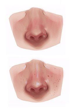 Nose Shading Reference, Manwha Art Style Reference, Wet Skin Drawing, How To Color Skin Digital, How To Render Skin, How To Shade Skin, Shading Techniques Digital, Drawing Step By Step Easy, Easy Pencil Drawing