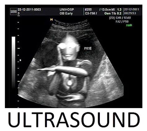 Ultrasound Pp Wa, Drama Memes, Random Meme, Cute Jokes, Jokes Pics, Funny Profile Pictures, Cartoon Jokes, Love Memes, Funny Reaction Pictures