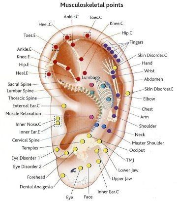 Piercing For Migraine Relief, Auricular Acupuncture, Acupressure Chart, Ear Surgery, Ear Reflexology, Ear Seeds, Acupuncture Benefits, Ear Pressure, Piercing Chart