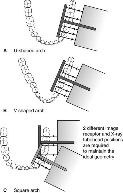 10: Bitewing radiography | Pocket Dentistry Dental Assistant Study Guide, Dental Assistant School, Dental Ideas, Dental Pictures, Dental Assistant Study, Dentist Assistant, Dental Hygiene Student, Dental Assisting, Dental World