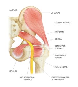 Osgood Schlatter Disease, Hip Injury, Body Surgery, Hip Injuries, Muscle Atrophy, Piriformis Syndrome, Pelvic Tilt, Surgery Recovery, Mind Body Connection