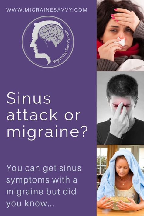 Sinus Migraine Relief, Occular Migraine, Migraine Meme, Migraine Types, Migraine Facts, Causes Of Migraine Headaches, Migraine Pressure Points, Sinus Migraine, Sinus Headache Relief