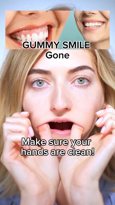 Smile exercise Mouth Exercises, Face Massage Anti Aging, Face Yoga Exercises, Gummy Smile, Lifting Workouts, Slimmer Face, Lose Inches, Smoothie Challenge, Simple Face