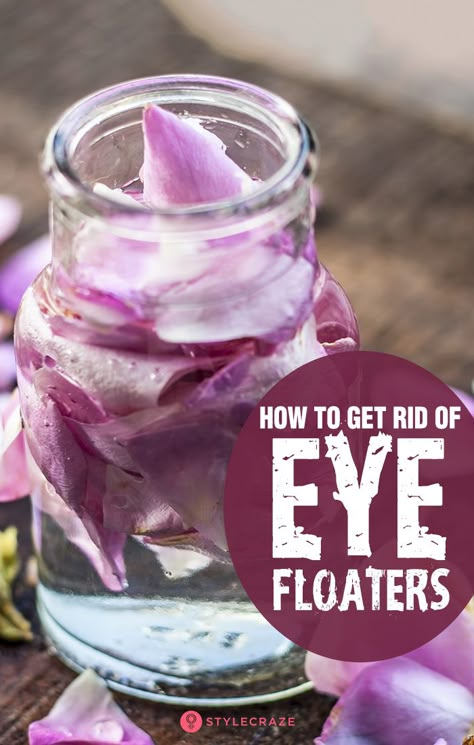 How To Get Rid Of Floaters In Your Eyes, Natural Remedies For Eyesight, How To Get Rid Of Eye Floaters, Irritated Eyes Remedies, Eye Floaters Remedies Natural Treatments, Castor Oil For Eye Floaters, Eye Floaters Remedies, How To Read Eyes, Floaters In The Eye