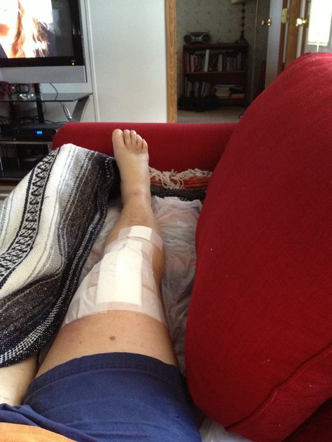 Knee replaced Sept, 3, 2013 Knee Injury Snapchat, Lucy Quinzel, Scraped Knee, Knee Pictures, Hip Brace, Riding Tips, Horse Riding Tips, Amazing Halloween Makeup, Knee Surgery